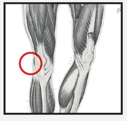 Re+ Techniques - Iliotibial Band Pain