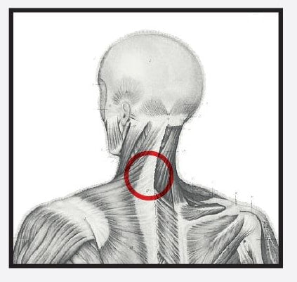 Re+ Techniques - Neck Pain