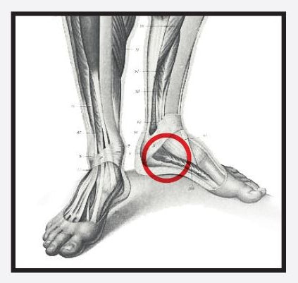 Re+ Techniques - Plantar Fascia Pain